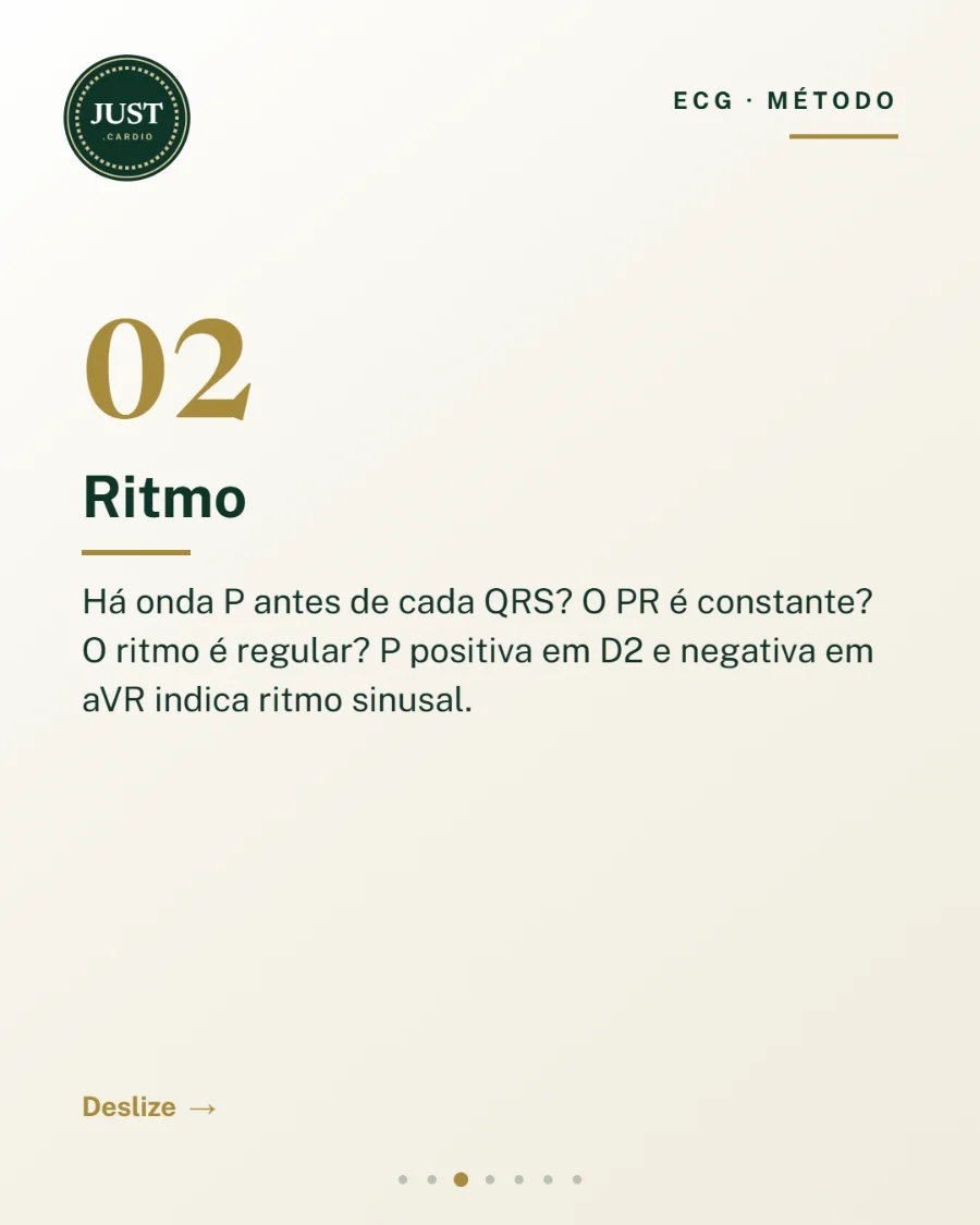 Passo 2 da leitura do ECG: ritmo sinusal, onda P e intervalo PR