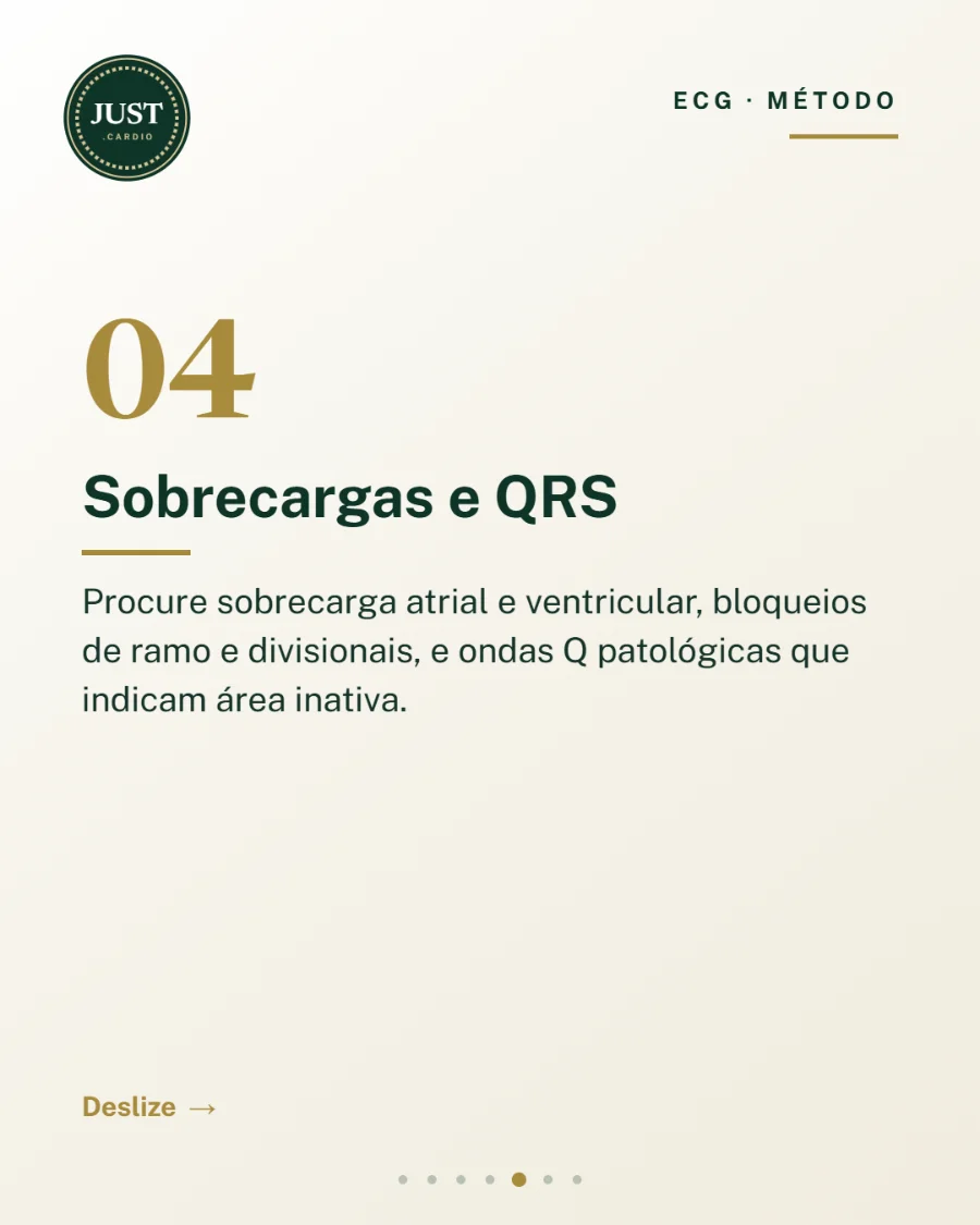 Passo 4 da leitura do ECG: sobrecargas, bloqueios de ramo e ondas Q patológicas