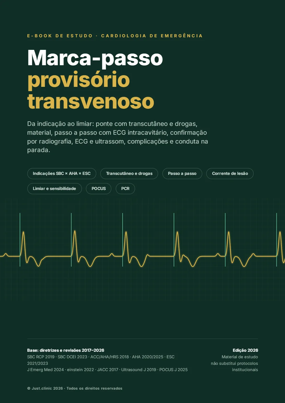 Capa do e-book Marca-Passo Transvenoso