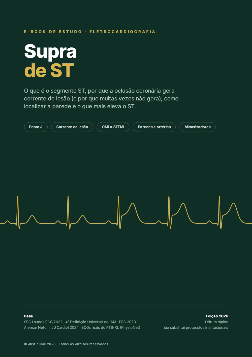 Capa do e-book Supra-ST e diagnósticos diferenciais