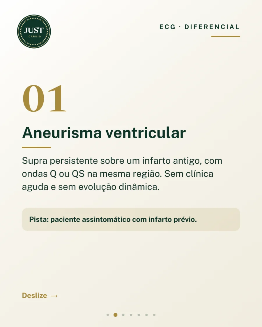 Aneurisma ventricular: supra de ST persistente sobre infarto antigo, com ondas Q ou QS