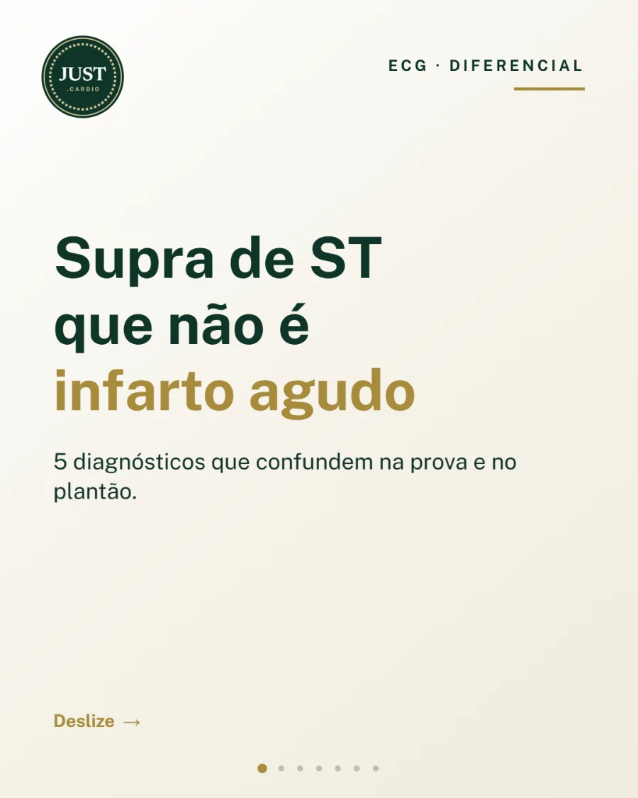 Supra de ST que não é infarto agudo: 5 diagnósticos diferenciais do eletrocardiograma